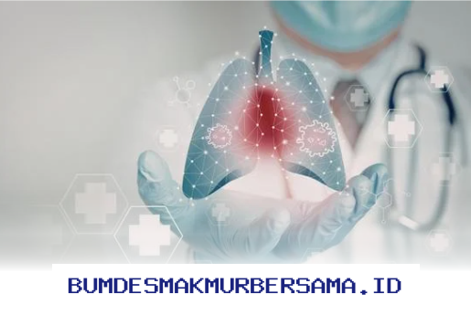 Dokter Spesialis Paru Medan yang Paling Banyak Direkomendasikan Pasien!